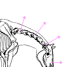 Straightening of the cervical spine in forward-down-out