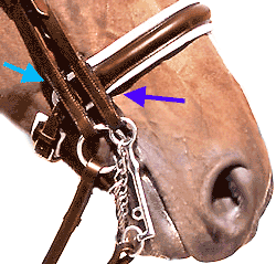 The padding of the crank pushes the cheeks against the teeth
