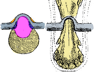 A narrow port