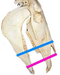 The different effects of the placement of the straps